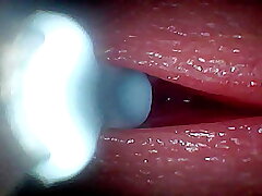 I couldn’t believe what happens INSIDE the penis painless sperm passes look over (endoscopic footage) asian careless sex videos old